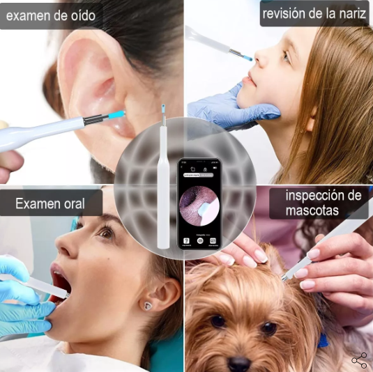 Otoscopio Inalámbrico con WiFi