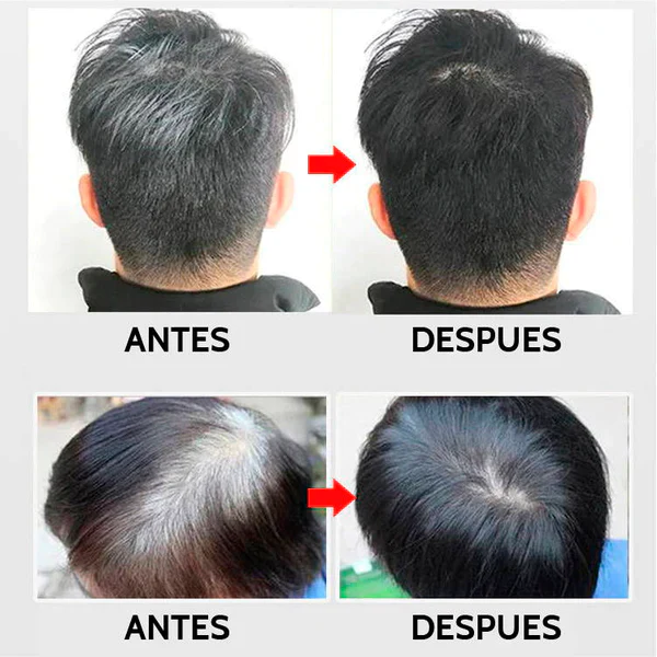 Shampoo Mágico Cubre Canas Negro – Pack De 10 Sobres