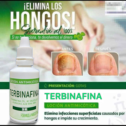 Terbinafina En Gotas Para Hongos En Tus Uñas