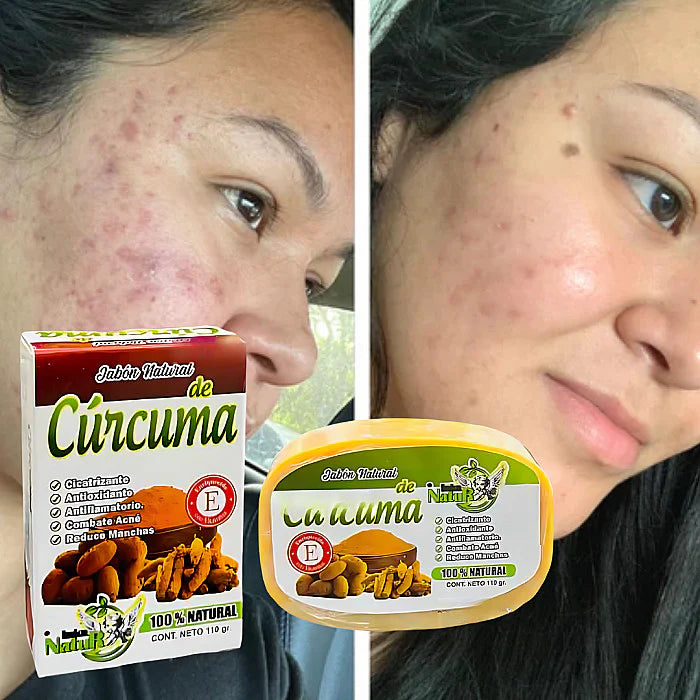 Jabon de Curcuma  2X1